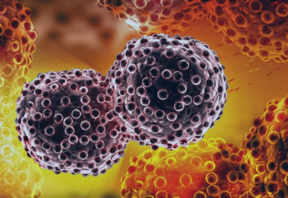 Câncer com metástase tem cura?