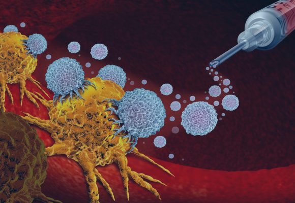 Tudo o que você precisa saber sobre imunoterapia