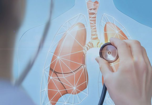 Tudo que você precisa saber sobre o câncer de pulmão