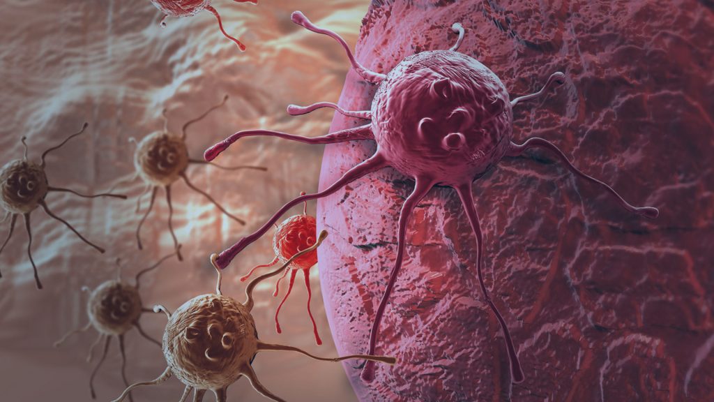 Todo tumor é um câncer? • OncoCorpore Todo tumor é um câncer? • OncoCorpore