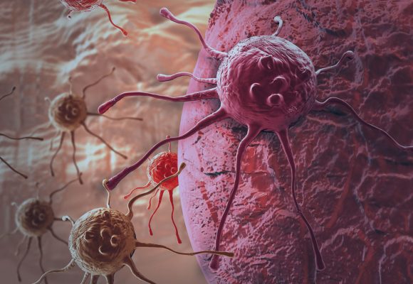 Todo tumor é um câncer?